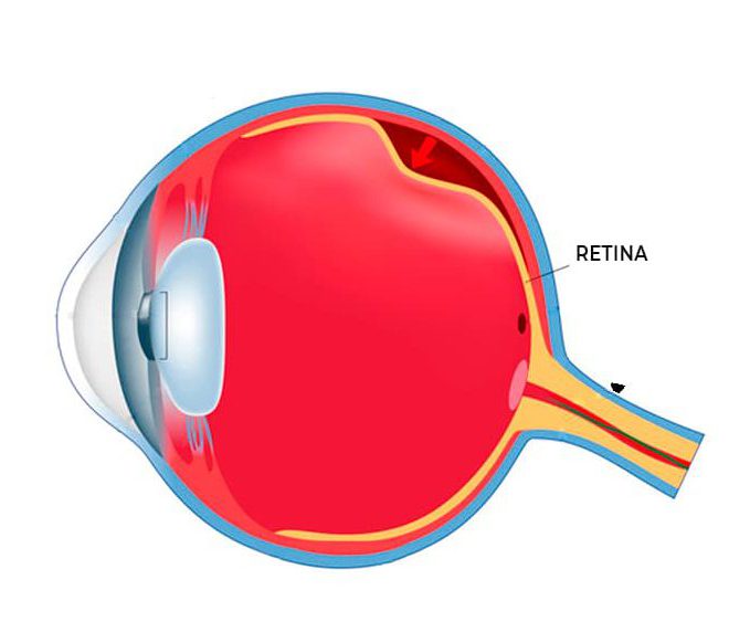 Retina ojo partes oftalmologia