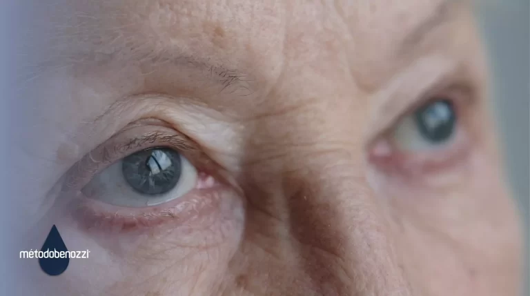 glaucoma